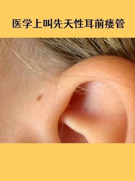 耳机放在耳机仓不断开