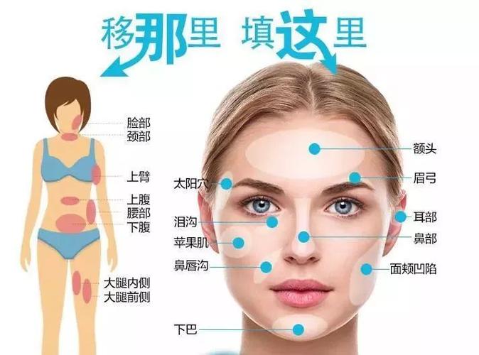 面部填充哪种最安全
