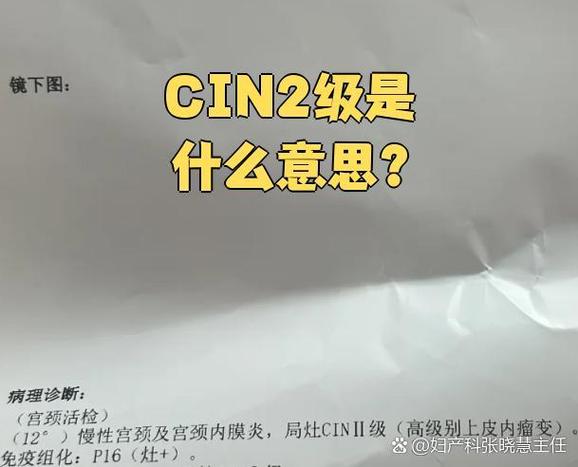 宫颈cin2级能治愈吗