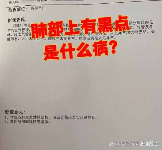 肺部黑点阴影