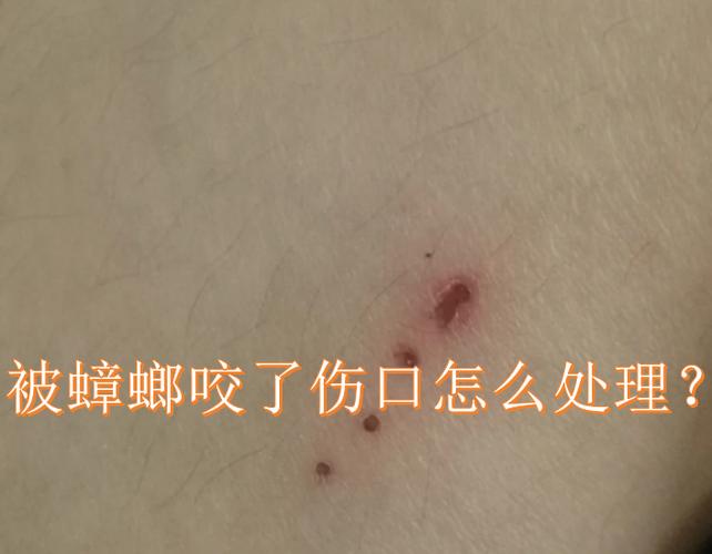 蟑螂啃过的痕迹特点截图