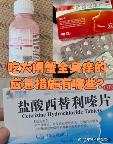 吃了螃蟹过敏痒怎么办