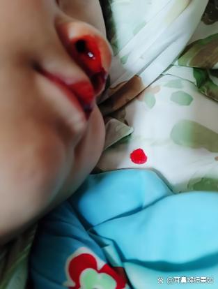 小孩子流鼻血可以焊接吗