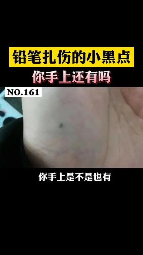 皮肤被笔戳伤留下颜色