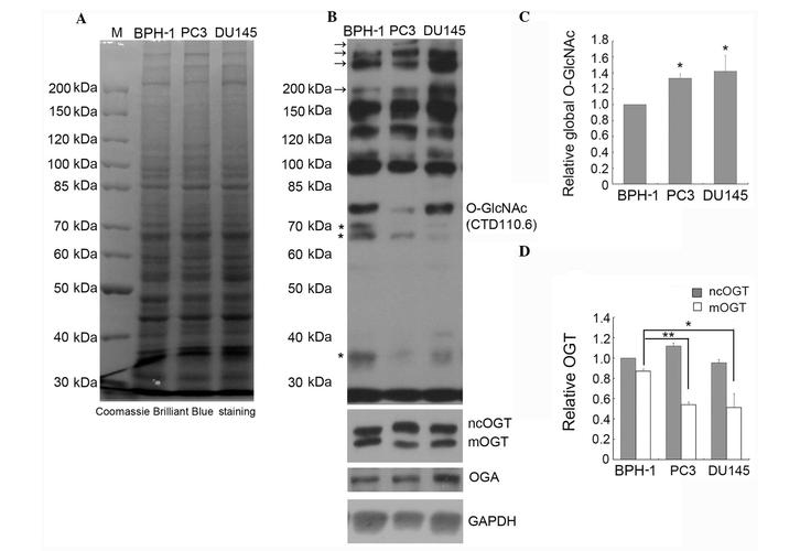O-GlcNAcylation