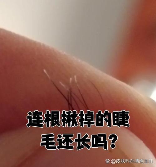 反复拔毛还会长出来吗