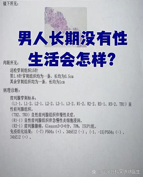 男性没有性冲动原因
