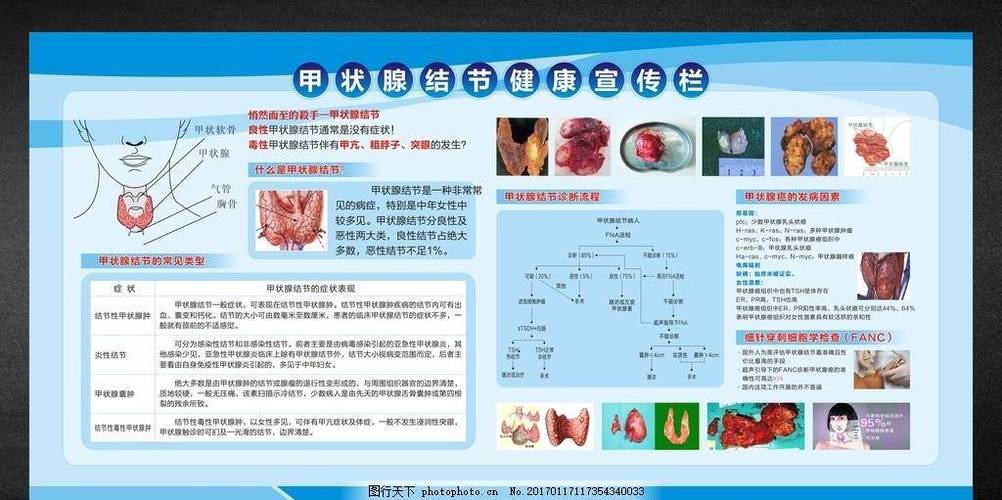 甲状腺不好的原因有哪些