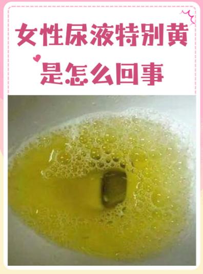 尿液检查尿液少了会不会影响结果截图