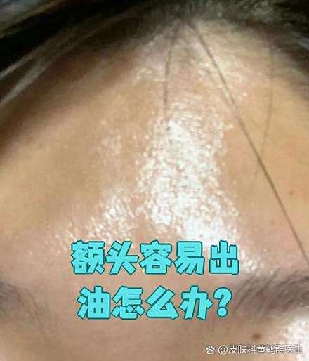 一天下来额头因为抹油出现臭味是什