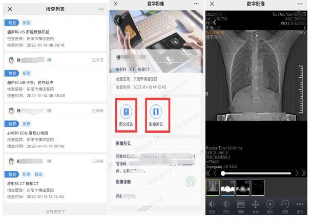怎么查看医疗云影像