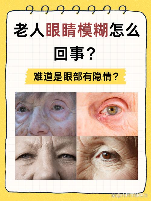 80多岁老人眼睛模糊看不清