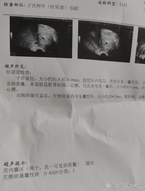 暗区过一周变孕囊了