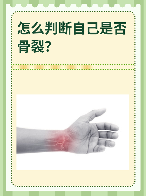 骨微裂的4大表现截图