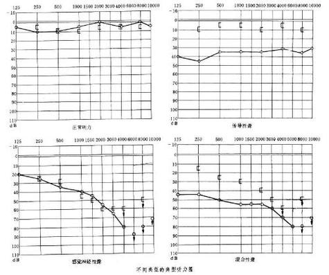 音箱打开电源就嗡嗡响