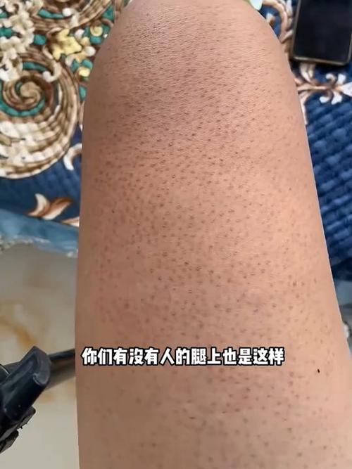身上搓出来的泥叫什么名字