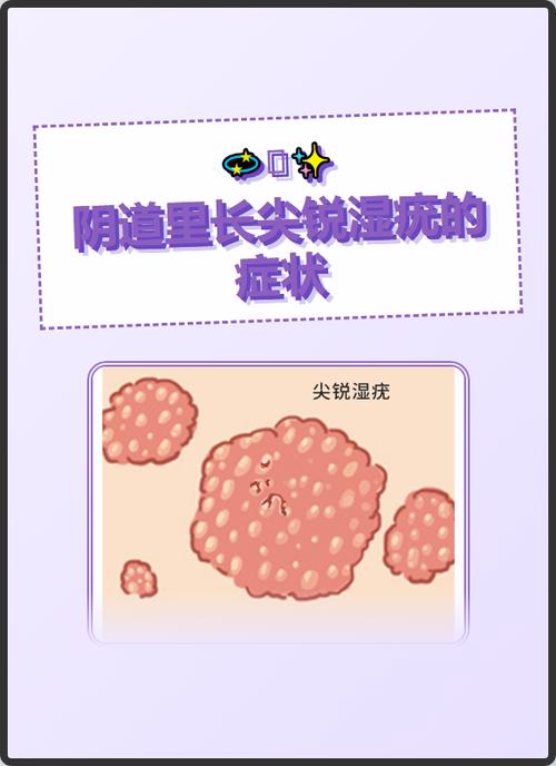 得了菜花有什么症状