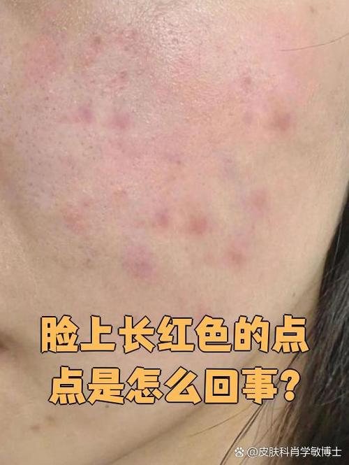 脸上棕褐色的小点是什么游戏截图