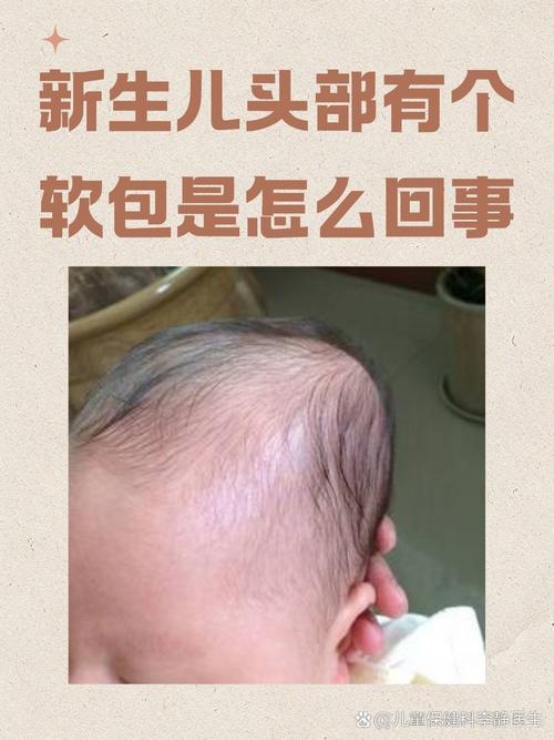 生孩子软化宫口多久生效