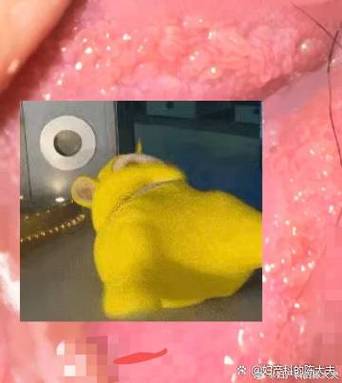 吃柚子死亡是真的吗