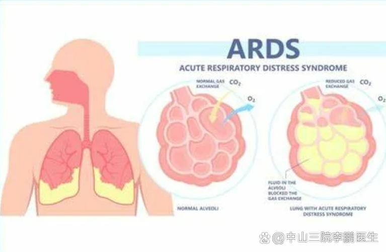 综合症是一种什么病缩略图