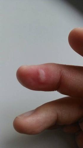 烫一下白色的泡图片