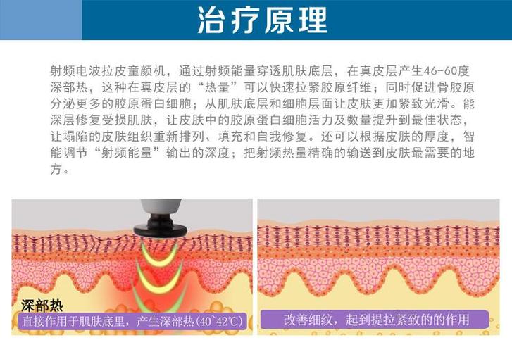 射频消耗皮肤结构