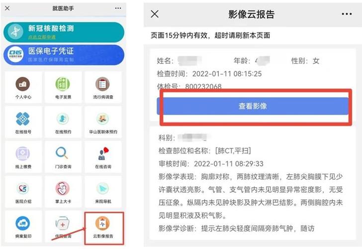 华西医院云胶片怎么查