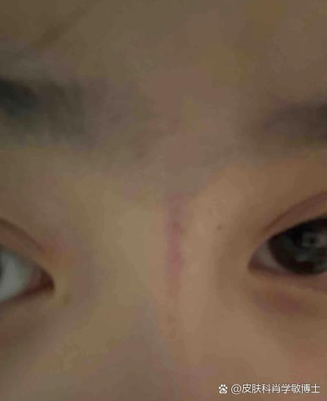 屏幕有紫色竖线缩略图