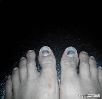 黑色毛呢甲教程