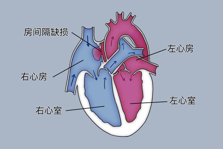 心脏房间隔在哪