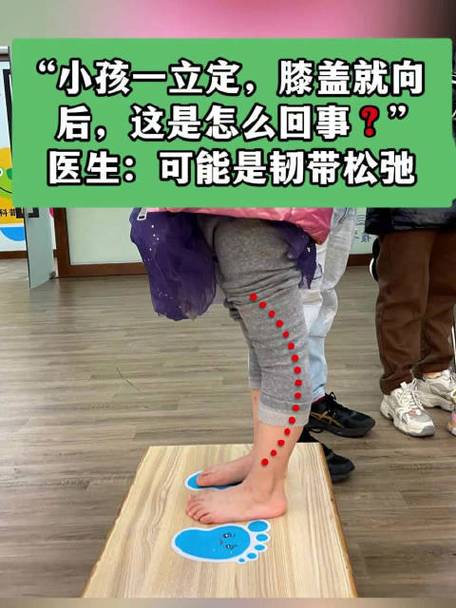 宝宝刚会走路感觉腿弯