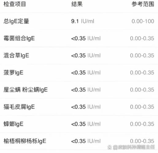 医院检查过敏源要多少钱