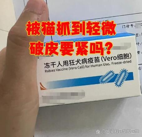 很小很小的伤口会得狂犬病吗