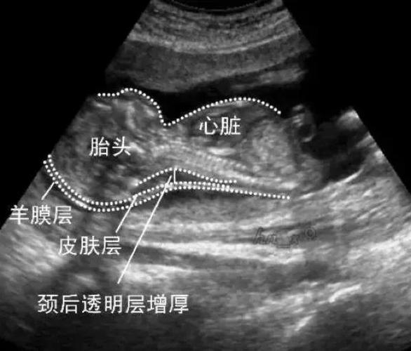 怀孕去医院检查多少钱一次缩略图