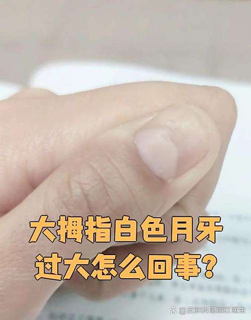 半月痕