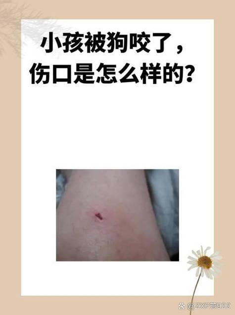 标记是咬哪里