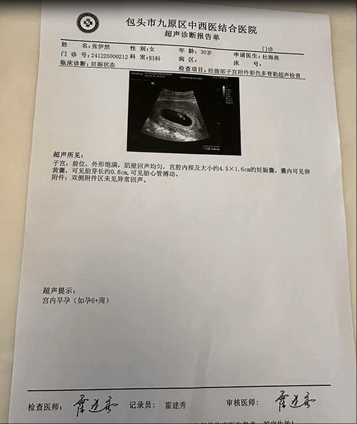 b超单交钱了几天有效