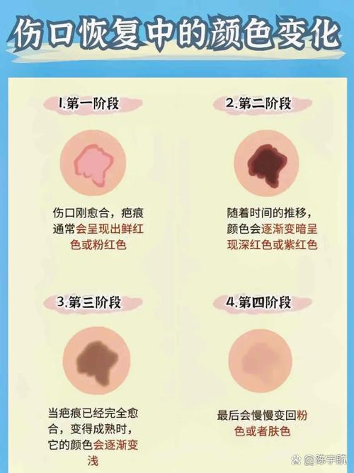 脸部擦伤留下的黑印怎么去除