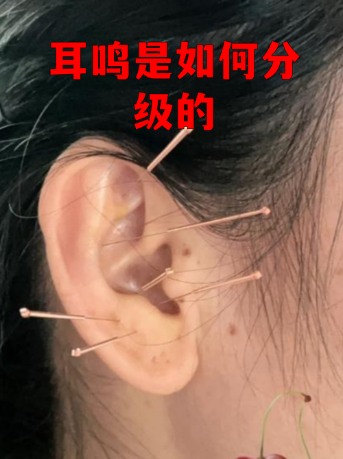 功放噼啪声要警惕四种病