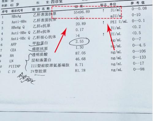 乙肝表面抗原250严重吗