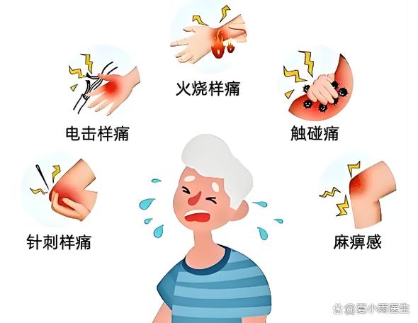 电击可分为哪几种