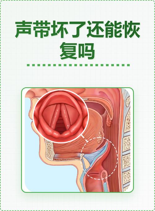 如何判断声带受损了