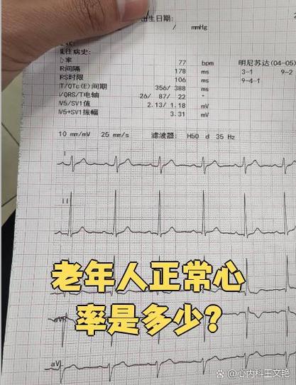 坐着不动心跳多少算正常