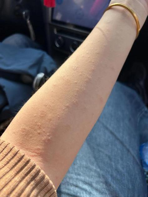 各种皮肤病截图