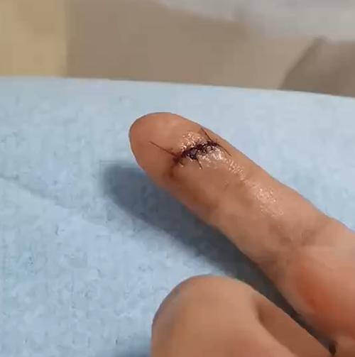 缝着东西突然针断了