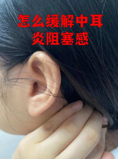 蓝牙耳机听断断续续缩略图