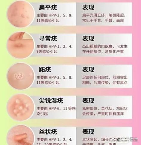 阴内长小肉是什么原因