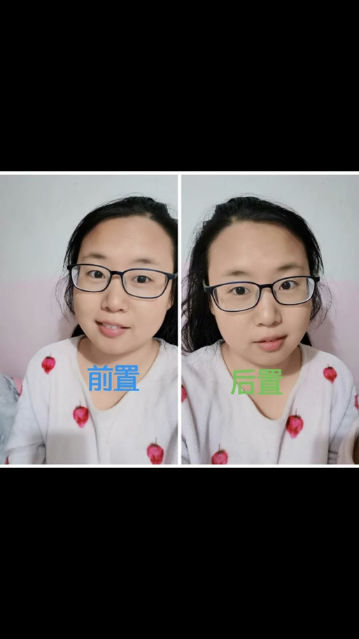 苹果后置脸歪怎么调整