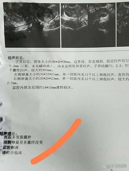 子宫内有暗区怎么办